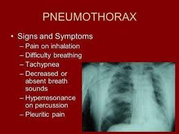Pneumothorax and hemothorax are collections of abnormal material (air and blood, respectively) within the chest (thoracic) cavity, in the space normally occupied by the tissue of the lungs. Pneumothorax Hemothorax Medical Knowledge Facebook