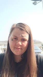 This may have been asked and if so please feel free to point me to the  post. How many of you that have become profoundly hard of hearing as an  adult have