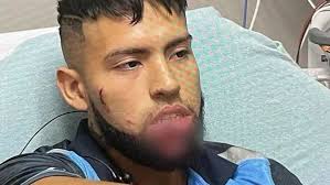 Amazon delivery driver seriously injured in pit bull attack