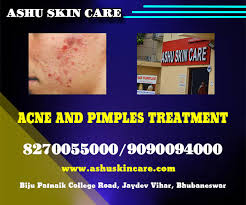 Laser clinics australia is australia's largest & most experienced network of clinics with over 130 locations across the country. Best Dermatologist In Bhubaneswar Skin Hair Treatment Specialist In Bhubaneswar Cuttack Odisha Ashu Skin Care