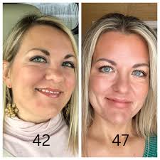 𝙀𝙓𝘾𝙄𝙏𝙄𝙉𝙂 𝙉𝙀𝙒𝙎! •DEAL IS NOW LIVE• • RIMAN IS HAVE A BOXING DAY  DEAL NOW through Dec 31st! BUY AN EXPERIENCE KIT (Expert Or Radiansome) and  𝙜𝙚𝙩 𝙖 $10 credit 𝙤𝙣 𝙖