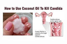 Pin On Treating