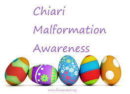 Malformation de chiari et travail. Chiari Malformation Chiari Chiari Malformation Projects