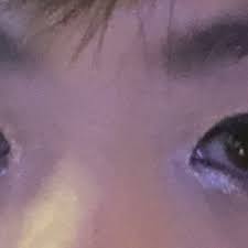 600 x 449 jpeg 27 кб. What Can Be Done For Asian Eyelids That Flip And Move Into Different Crease Positions Depending On The Day Photos