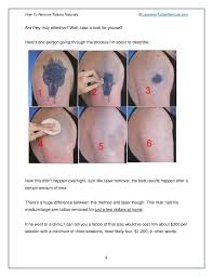 Sejal shah, founder of smarterskin dermatology. Rejuvi Tattoo Removal Cream Price Tattoo Pain Guide Tattoo Removal Do