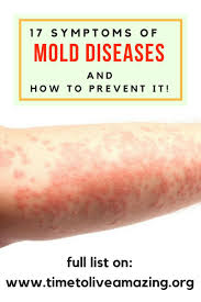 17 Symptoms Of Mold Disease And How To Prevent It Time To Live Amazing Symptoms Of Mold Prevention Disease Infographic