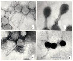 A coronavirus variant known as lambda is gaining the attention of health officials as it spreads some of these mutations have the potential to increase transmissibility of the virus or to reduce the. Microorganisms Free Full Text Sad State Of Phage Electron Microscopy Please Shoot The Messenger Html