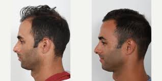 Benjamin C. Paul, MD, Board Certified Facial Plastic Surgeon