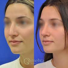 Mehta Plastic Surgery added a new...