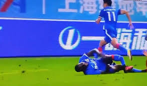 We did not find results for: Coral On Twitter Get Well Soon Demba Ba Horrific Injury Not What You Want To See On A Football Pitch Cfc Nufc Whufc
