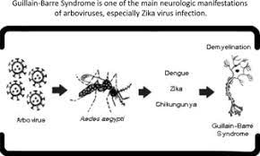 Guillain Barre Syndrome And Its Correlation With Dengue Zika And Chikungunya Viruses Infection Based On A Literature Review Of Reported Cases In Brazil Sciencedirect