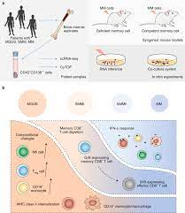 Related online courses on physioplus. Stepwise Immune Alterations In Multiple Myeloma Progression Nature Cancer