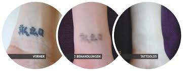 Don't apply body lotions, fragrances, oil, and similar products after bathing. Before And After Pictures Tattoolos