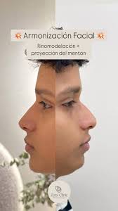 Conocíais nuestro servicio de Control del peso? 🤩 El Dr. Efraín Cordero,  endocrinólogo, nos cuenta más sobre el control ponderal ❤️ 📉 Mantener un  peso saludable no solo se trata de la