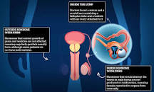 67-year-old father goes to hospital with hernia... to find ...