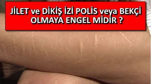 Dikis Ve Jilet Izi Polis Bekci Olmaya Engel Midir Poh Pomem Bekci Besyo Pmyo Astsubaylik Hazirlik Kursu