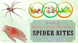 16 Natural Home Remedies For Spider Bites You Should Know Spider Bites Home Remedies For Spiders Home Remedies