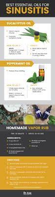 Pin On Young Living Essential Oils