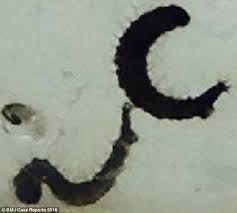 The worms are brown or black about 3/8 inches long. Woman Who Peed Worms For 3 Months Is Found To Have Infestation Of Fly Larvae In Her Bladder Daily Mail Online