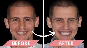 David's Smile Journey with Andy McIntyre