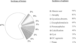 Pie Chart Depicting The Relative Frequency Of Epilepsy In