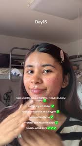 one of the few kbeauty fungal acne safe products is the eqqualberry sw...