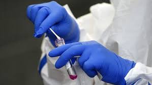 Nun haben sich die länder auf ein kontaktverbot geeinigt, keine ausgangssperre. Neuer Hochststand 2 395 Neue Infektionen In Niedersachsen Ndr De Nachrichten Niedersachsen