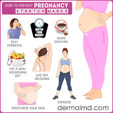 Pin On Get Rid Of Stretch Marks