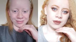 Albino definition, a person with pale skin, light hair, pinkish eyes, and visual abnormalities resulting from a hereditary inability to produce the pigment melanin. Albino Makeup Transformation Youtube