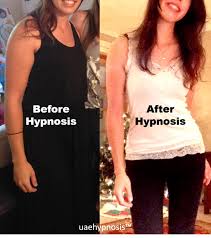 hypnosis for weight loss a nurse s