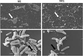 Trt 1 seyret, trt 1 canlı yayın, trt 1 i̇zle, trt 1 canlı, trt 1 canlı i̇zle ve trt 1 canlı mobil gibi kelimelerde canlitv.today sayfasından izleyebilirsiniz. Scanning Electron Microscopy Of H Rubrisubalbicans Strains M1 And Trt1 Download Scientific Diagram