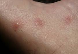 Skin rashes seen depend on the virus involved. Skin Conditions Caused By Diabetes And Other Skin Care Tips
