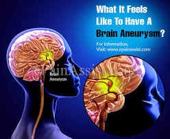 Any of these symptoms requires immediate. What It Feels Like To Have A Brain Aneurysm Know Its Treatment Recovery