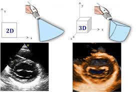 The term 2d and 3d are used to indicate dimensions. Comparison Between 2d And 3d