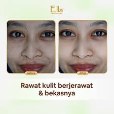 Jual ella skincare kudus Harga Terbaik & Termurah Desember 2025