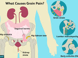 In the groin underneath the skin there are three to five deep inguinal lymph nodes that play a role in the immune system. Groin Pain Causes Treatment And When To See A Doctor