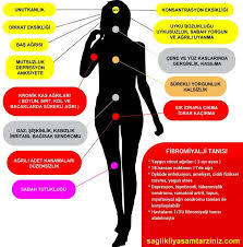Kpwhite ve ark.'na göre fibromiyalji sendromunun sıklığı. Love House Fibromiyalji
