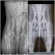 Image result for Hip XRay