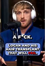 Logan Paul's Hair Transplant Journey Explained