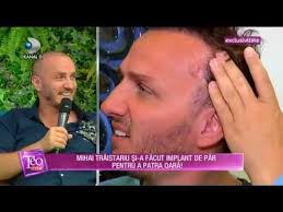 Srtr designs and carries out data analyses and maintains two websites to disseminate organ transplant information. Teo Show 16 05 2018 Mihai Trastariu Si A Facut Implant De Par Partea 2 Youtube