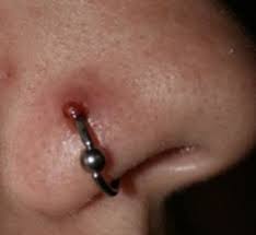 Crush three to four aspirin tablets. Nose Piercing Bump 6 Causes And How To Treat Them Authoritytattoo