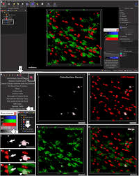 Part a drag the labels onto the diagram to identify the components of the integumentary system. Quantification Of Microglial Contact And Engulfment Of Oligodendrocyte Progenitor Cells In The Rodent Brain Star Protocols
