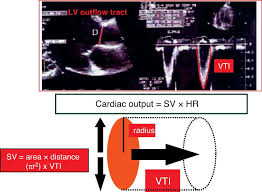 Image result for Cardiac Output