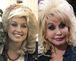 The Rise Of The Pillow Face Bad Celebrity Plastic Surgery Bad Plastic Surgeries Plastic Surgery