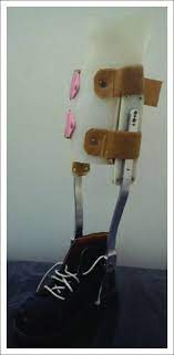 2 doctor answers • 4 doctors weighed in. Ptb Brace With Metal Double Upright Brace And Adjustable Thermoplastic Download Scientific Diagram