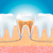 Generally, crowns do not hurt. Root Canal Cost Recovery Time Infection Duration Of Procedure