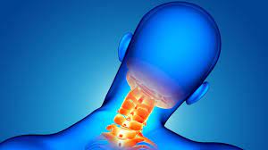 The intervertebral discs are located between adjacent vertebral bodies. Hernia De Disc CervicalÄƒ Home Kineto