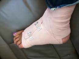 Try sleeping with the foot and ankle propped up on pillows at a. 8 Completely Natural Ways To Treat Sprained Ankles