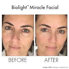 Hydra medic® sea mud perfecting mask $ 32.00. Repechage Clare Agius Repechage Skin Care Routine Facebook
