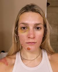 For those of you that are getting bored of the typical end year  highlights…my 2023 was a shiner 👀🖤😂